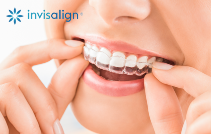 HAVE YOU HEARD OF INVISALIGN?