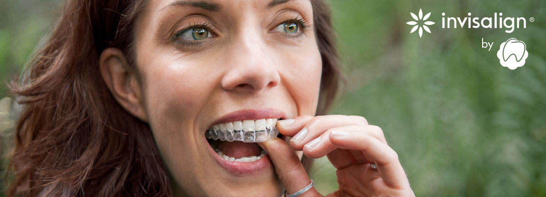 INVISALIGN. Onzichtbare orthodontie