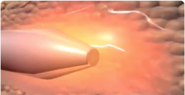 Video Img