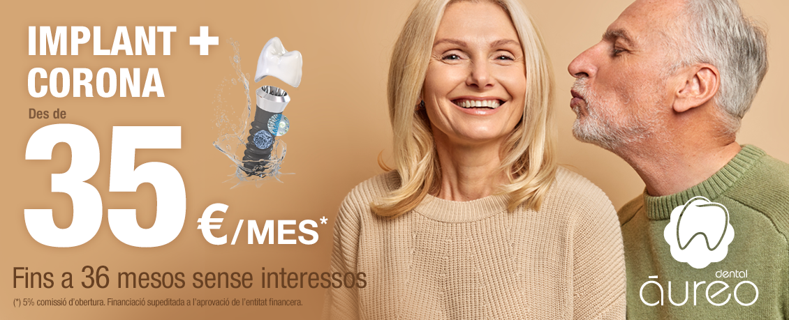 Clinica-Aureo-Promocio-Implant-mes-corona