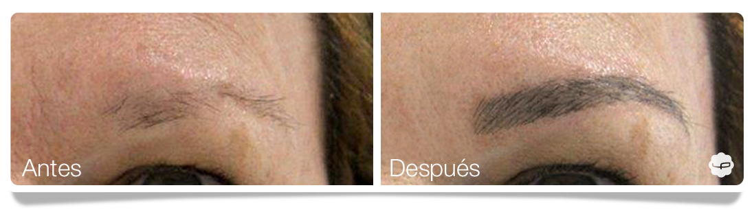 Clinica-Aureo-Dermopigmentación-de-cejas-Antes-despues-ES 05.png