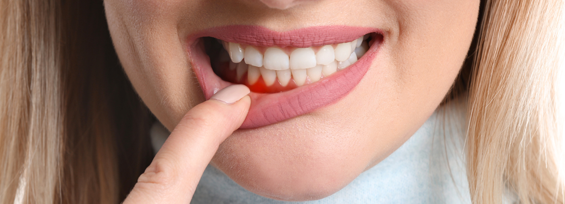 Periodoncia