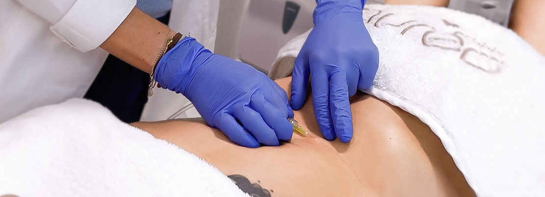 Carboxiterapia Corporal