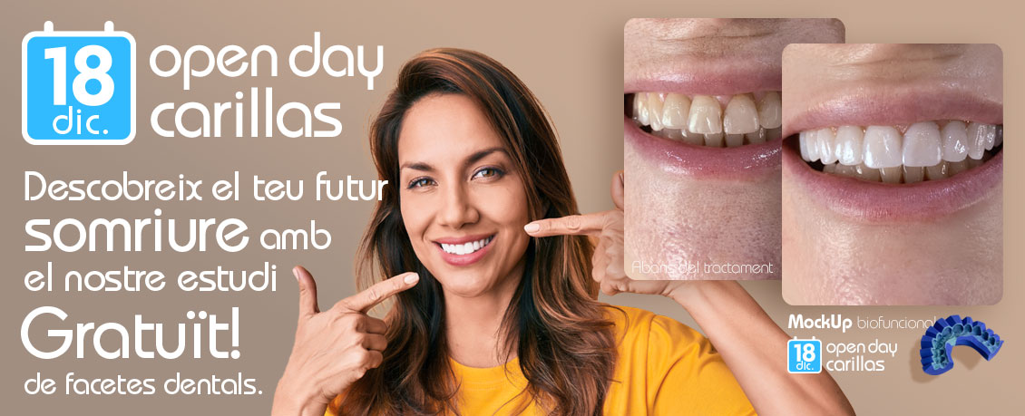 OPEN DAY FACETES
