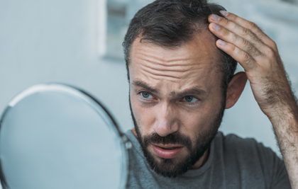  TEST FOR THE PREVENTION OF ALOPECIA. TRICHOTEST