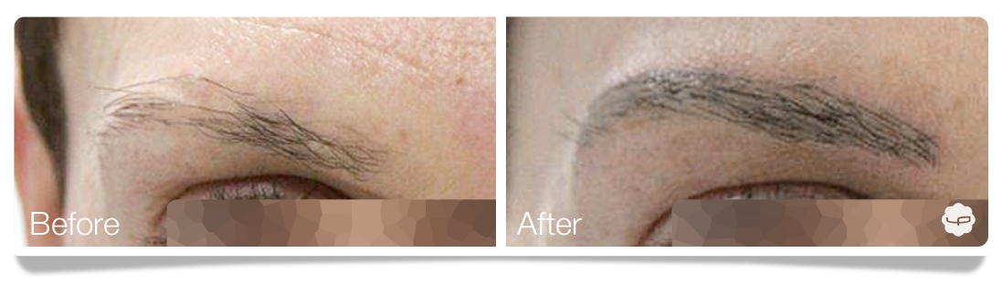 Clinica-Aureo-Dermopigmentation-eyebrows-Before-After-EN 06.png