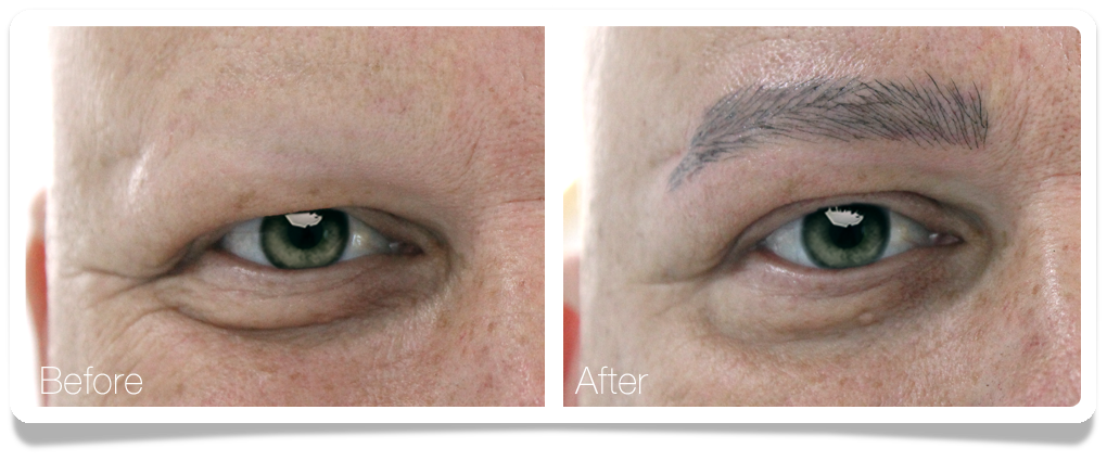 Clinica-Aureo-Dermopigmentation-Medical-Eyebrows-Man-EN.png