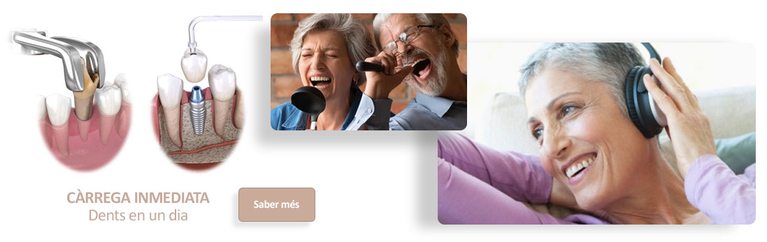 Implants de càrrega immediata