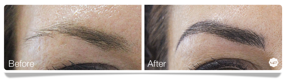 Clinica-Aureo-Dermopigmentation-eyebrows-Before-After-EN 02.png