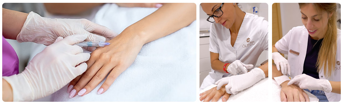 Revitalising Mesotherapy hands