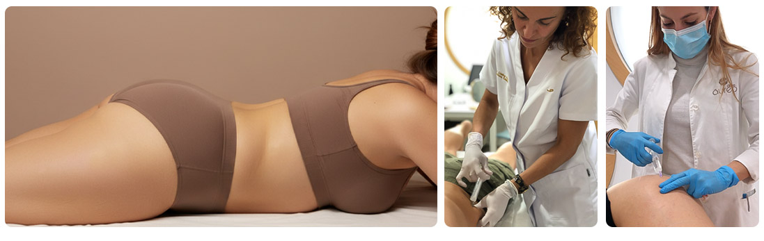 Intralipotherapy