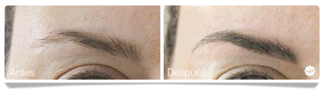 Clinica-Aureo-Dermopigmentación-de-cejas-Antes-despues-ES 01.png