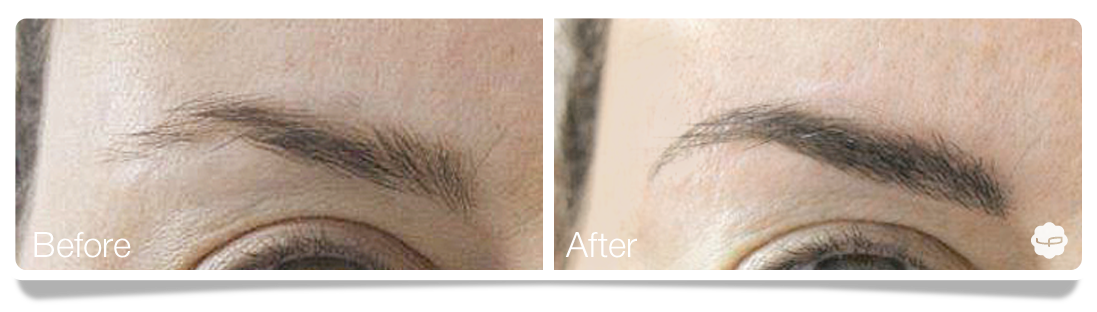 Clinica-Aureo-Dermopigmentation-eyebrows-Before-After-EN 01.png