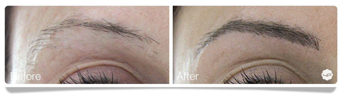 Clinica-Aureo-Dermopigmentation-eyebrows-Before-After-EN 04.png
