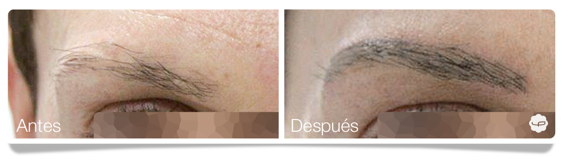 Clinica-Aureo-Dermopigmentación-de-cejas-Antes-despues-ES 06.png