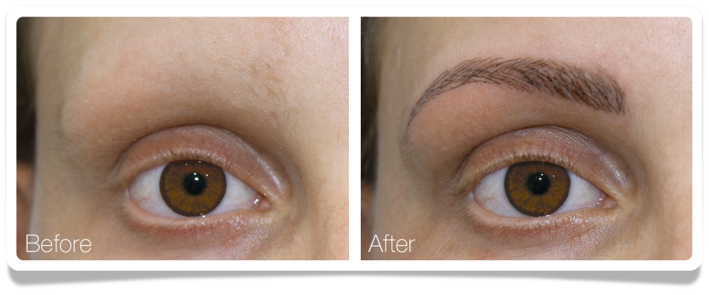 Clinica-Aureo-Dermopigmentation-Medical-Eyebrows.png
