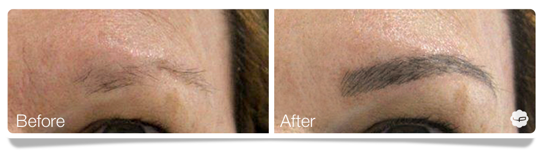 Clinica-Aureo-Dermopigmentation-eyebrows-Before-After-EN 05.png