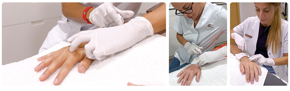 Collagen Biostimulation